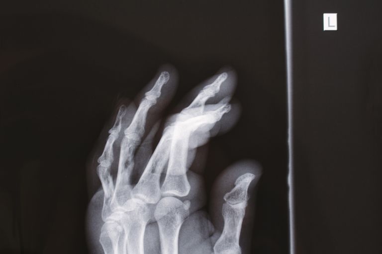 オーストラリアの健康保障と予防医療の展望